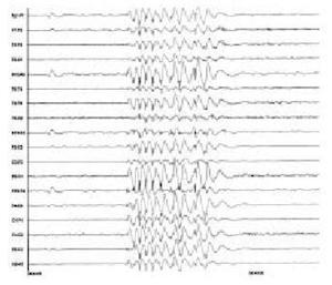 Clínica Especializada En Epilepsia y Sueño - Diagnóstico y tratamiento para la epilepsia